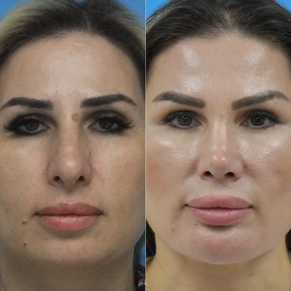 Case 08 — before and after