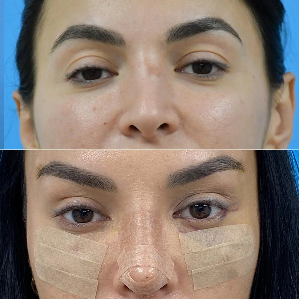 Case 06 — before and after
