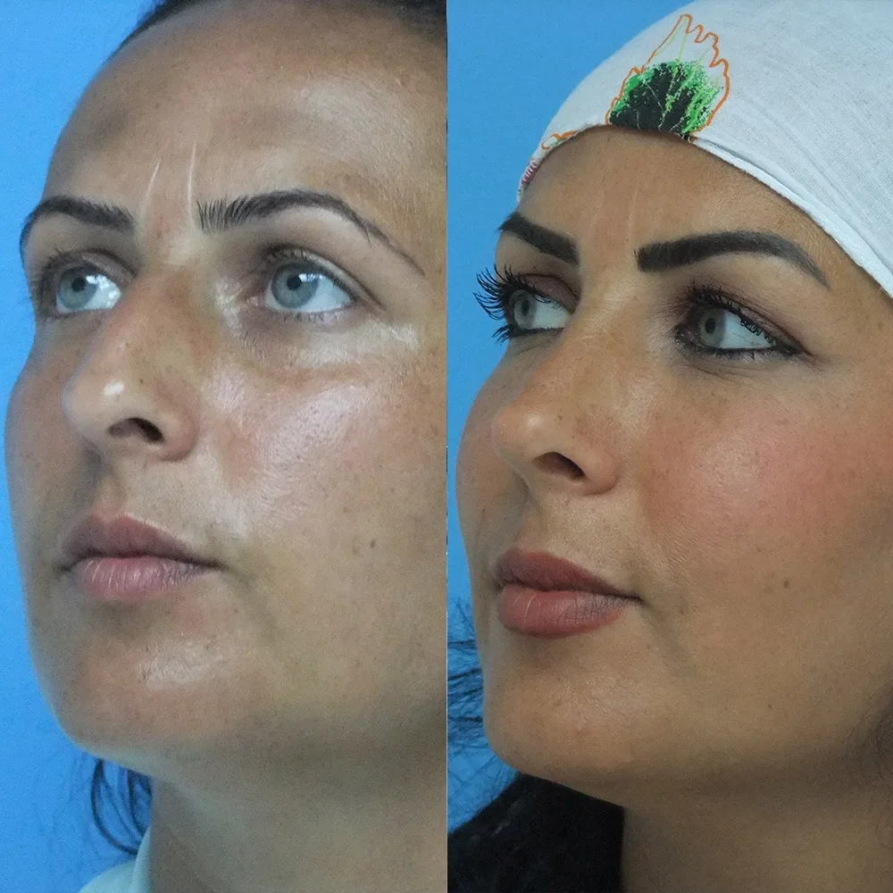 Case 05 — before and after