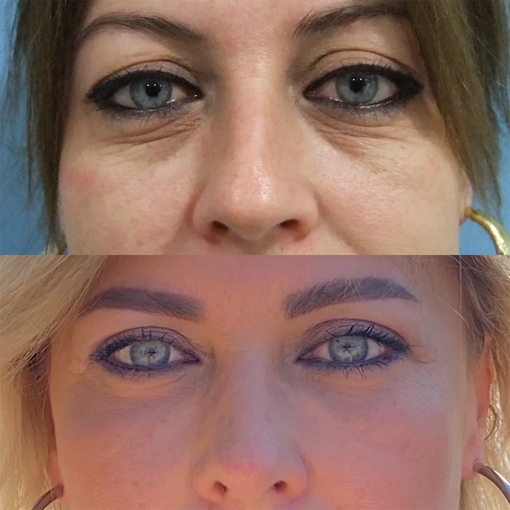 Case 02 — before and after