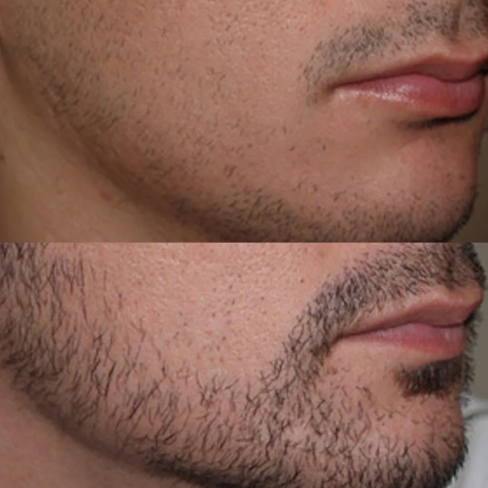 Case 01 — before and after