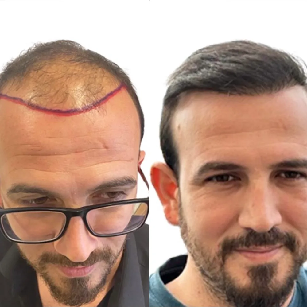 Case 01 — before and after