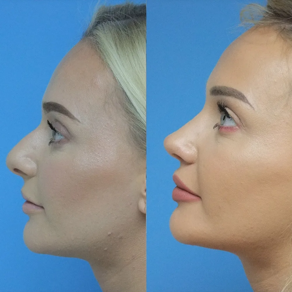 Case 04 — before and after