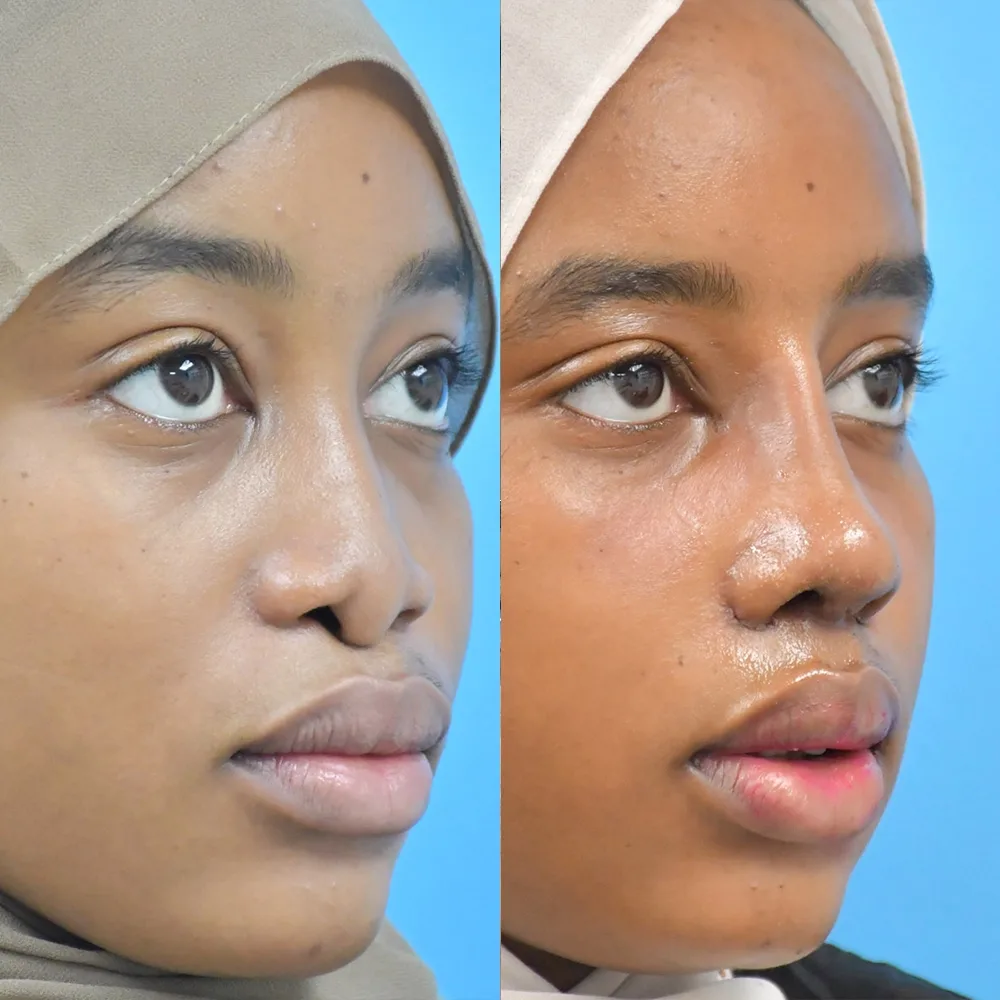 Case 10 — before and after