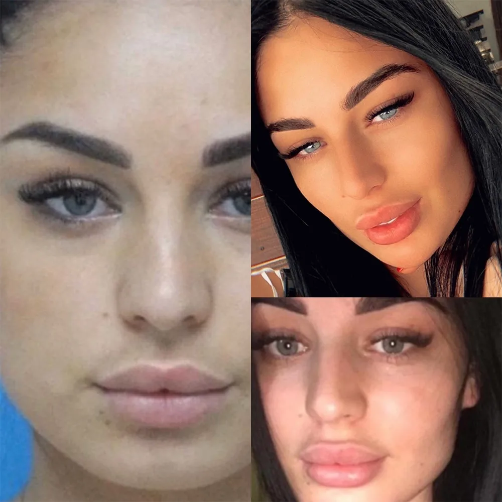 Case 02 — before and after