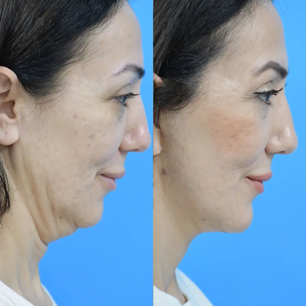 Case 08 — before and after