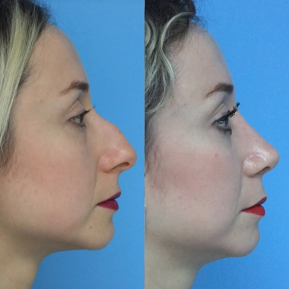 Case 07 — before and after