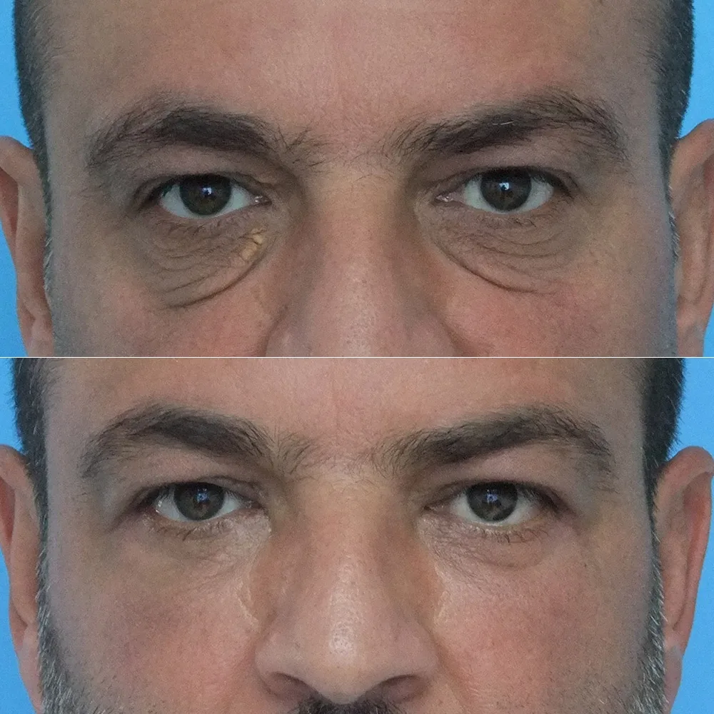 Case 06 — before and after