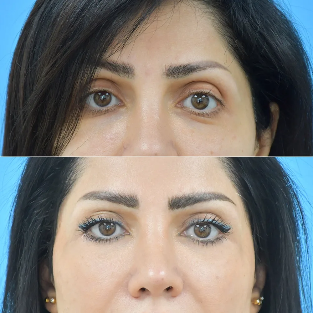 Case 04 — before and after