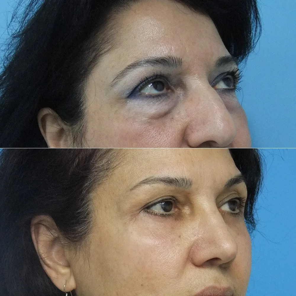 Case 07 — before and after