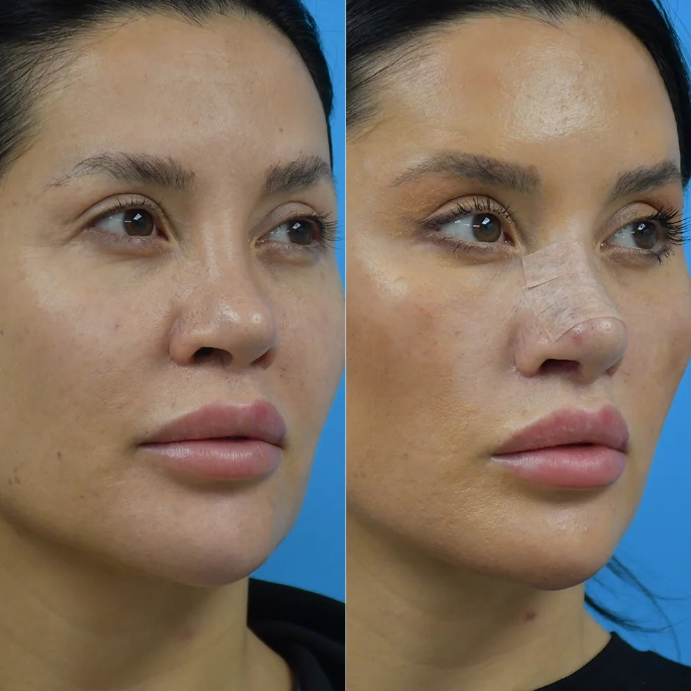 Case 01 — before and after
