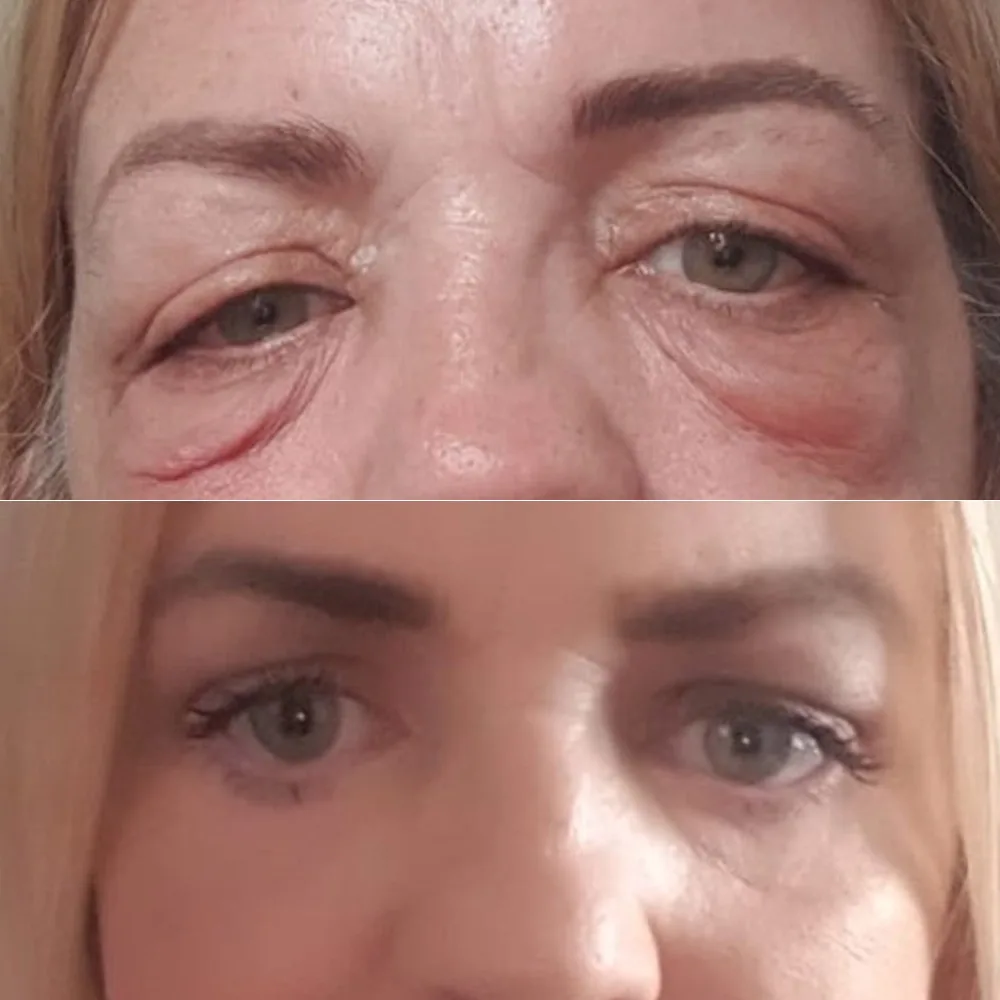 Case 05 — before and after