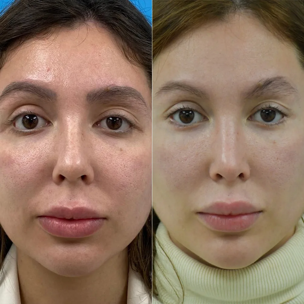 Case 03 — before and after