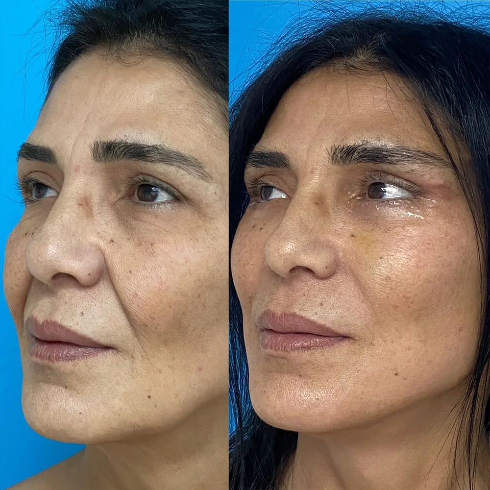 Case 01 — before and after