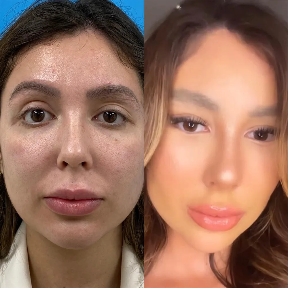 Case 03 — before and after