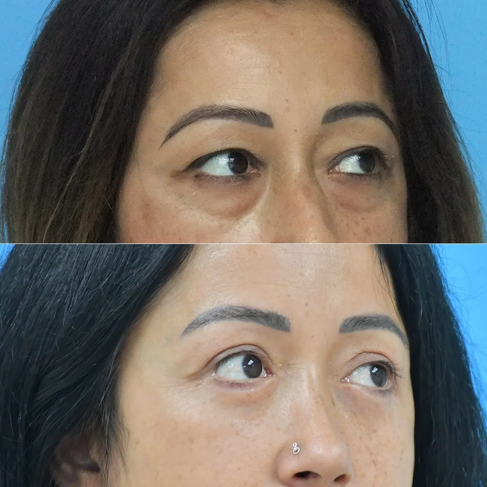 Case 12 — before and after