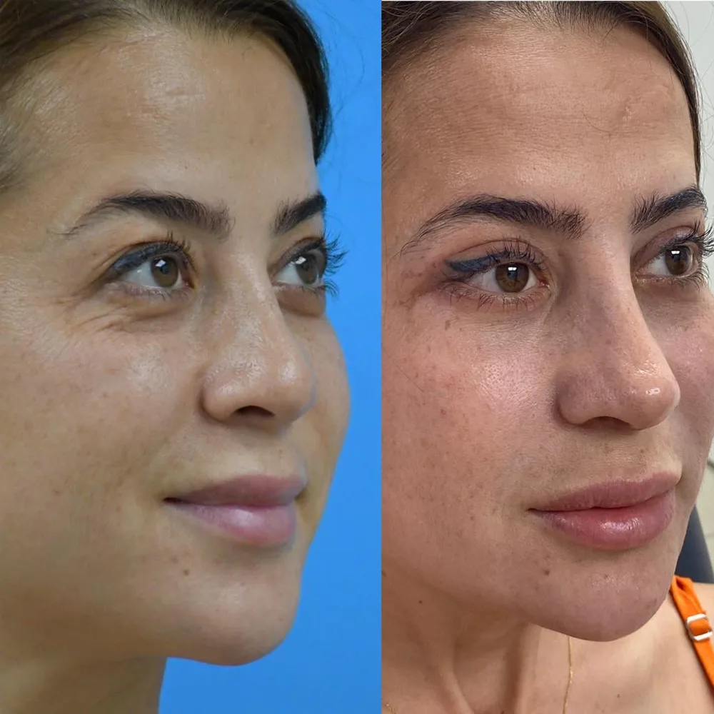 Case 10 — before and after
