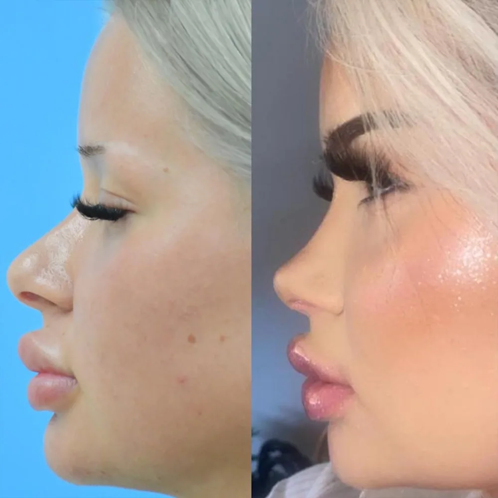 Case 01 — before and after