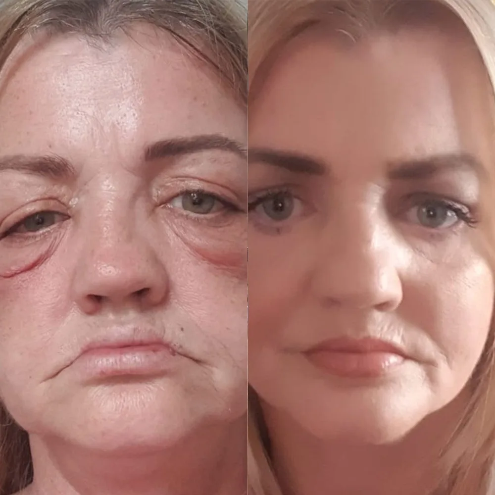 Case 01 — before and after