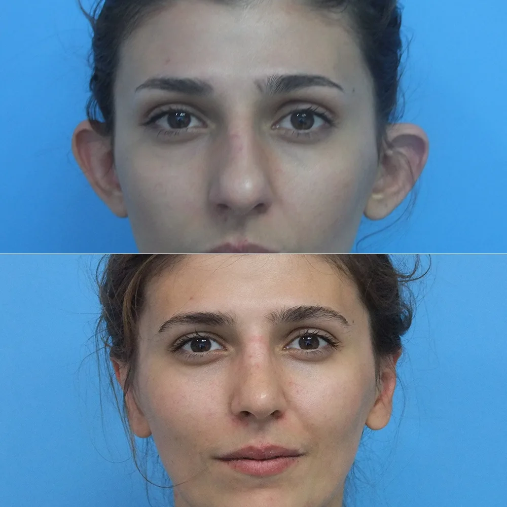 Case 01 — before and after