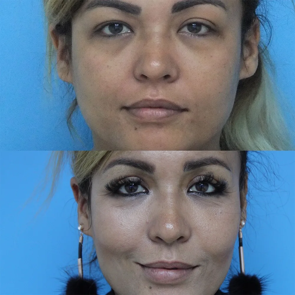Case 01 — before and after