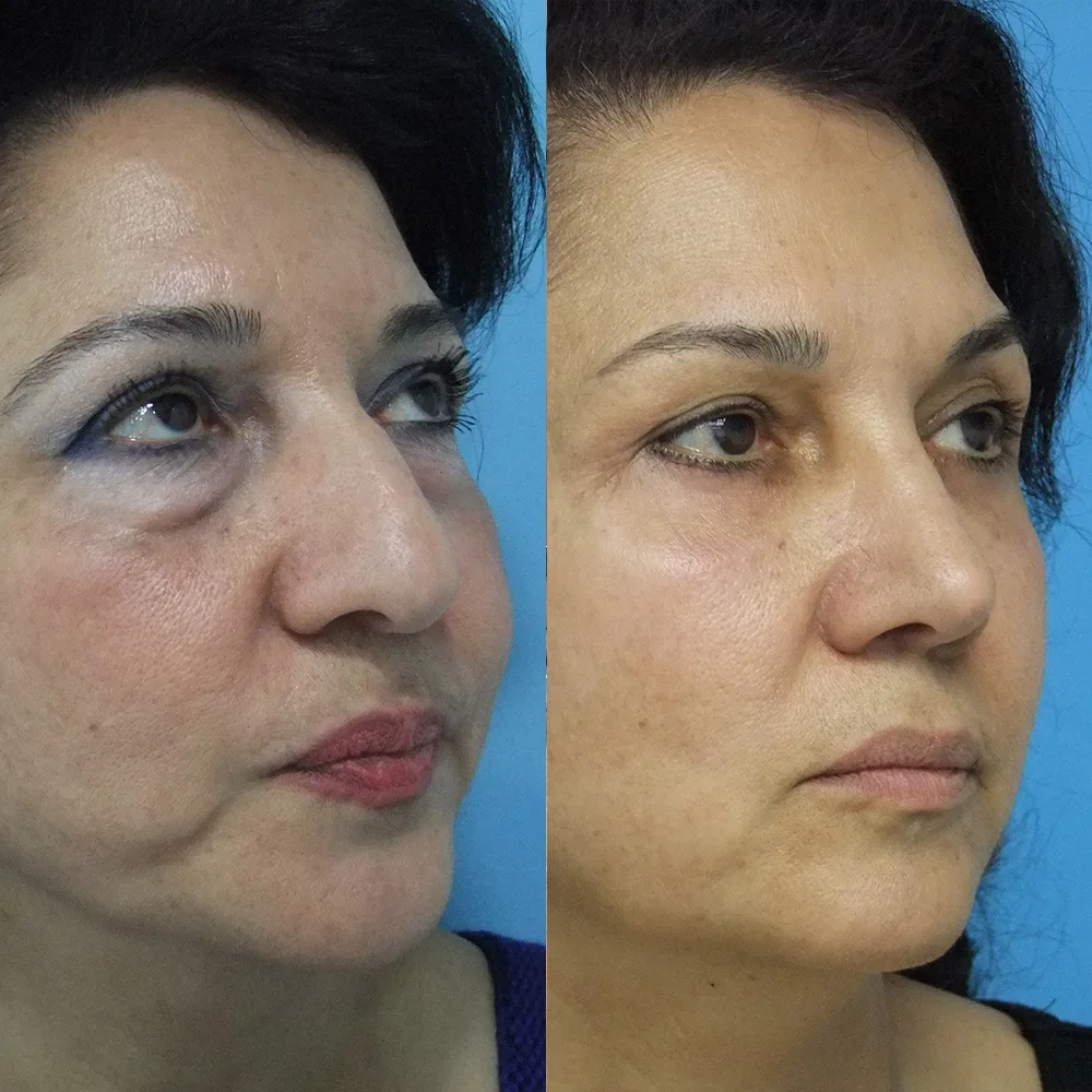 Case 03 — before and after