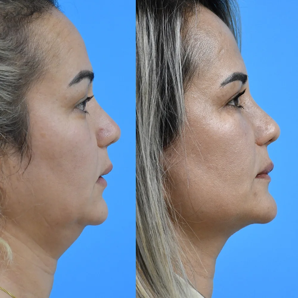 Case 02 — before and after