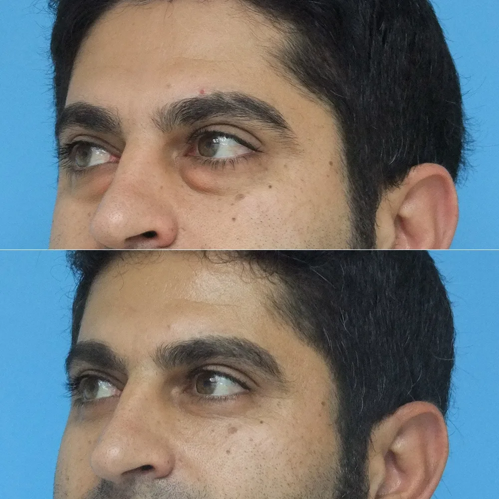 Case 09 — before and after