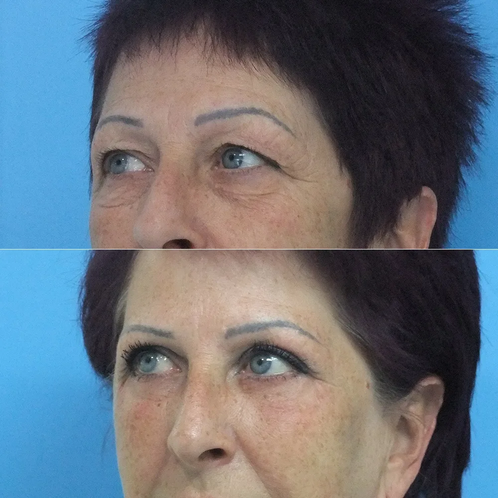 Case 03 — before and after