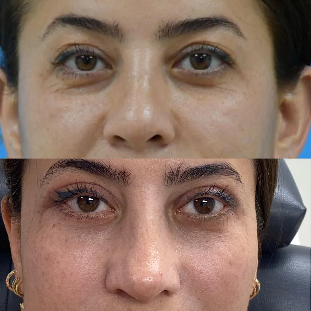 Case 04 — before and after