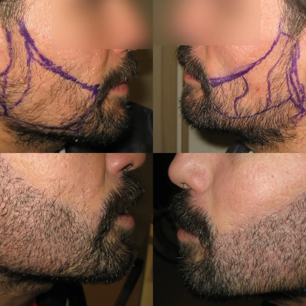 Case 02 — before and after