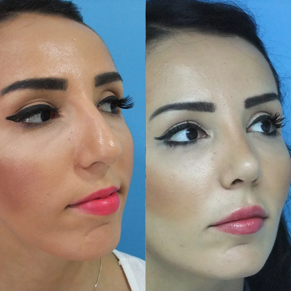 Case 08 — before and after