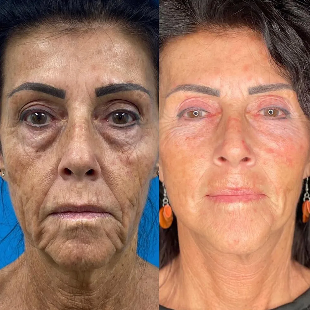 Case 03 — before and after