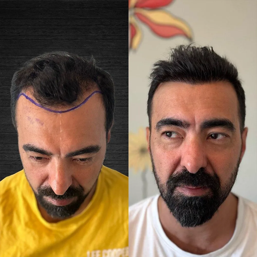 Case 05 — before and after