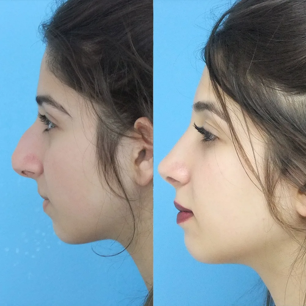 Case 09 — before and after