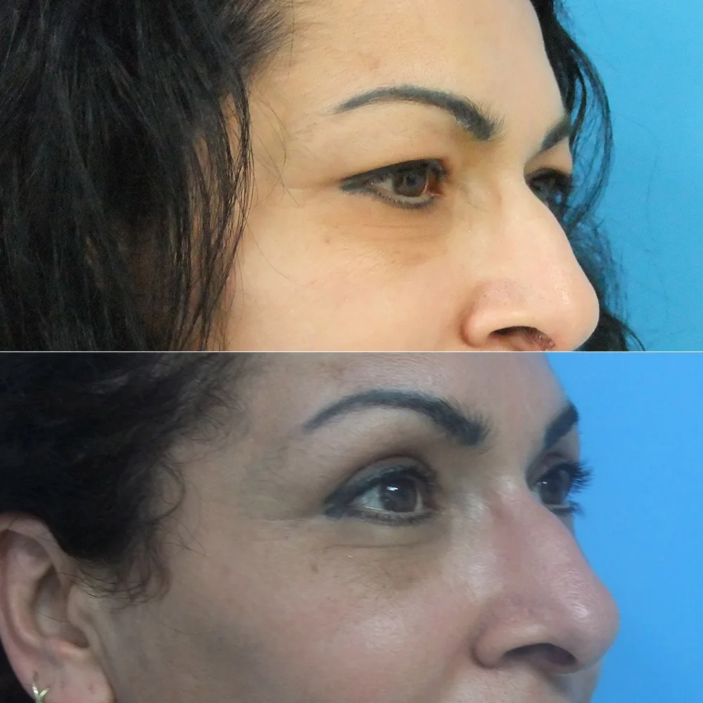 Case 02 — before and after