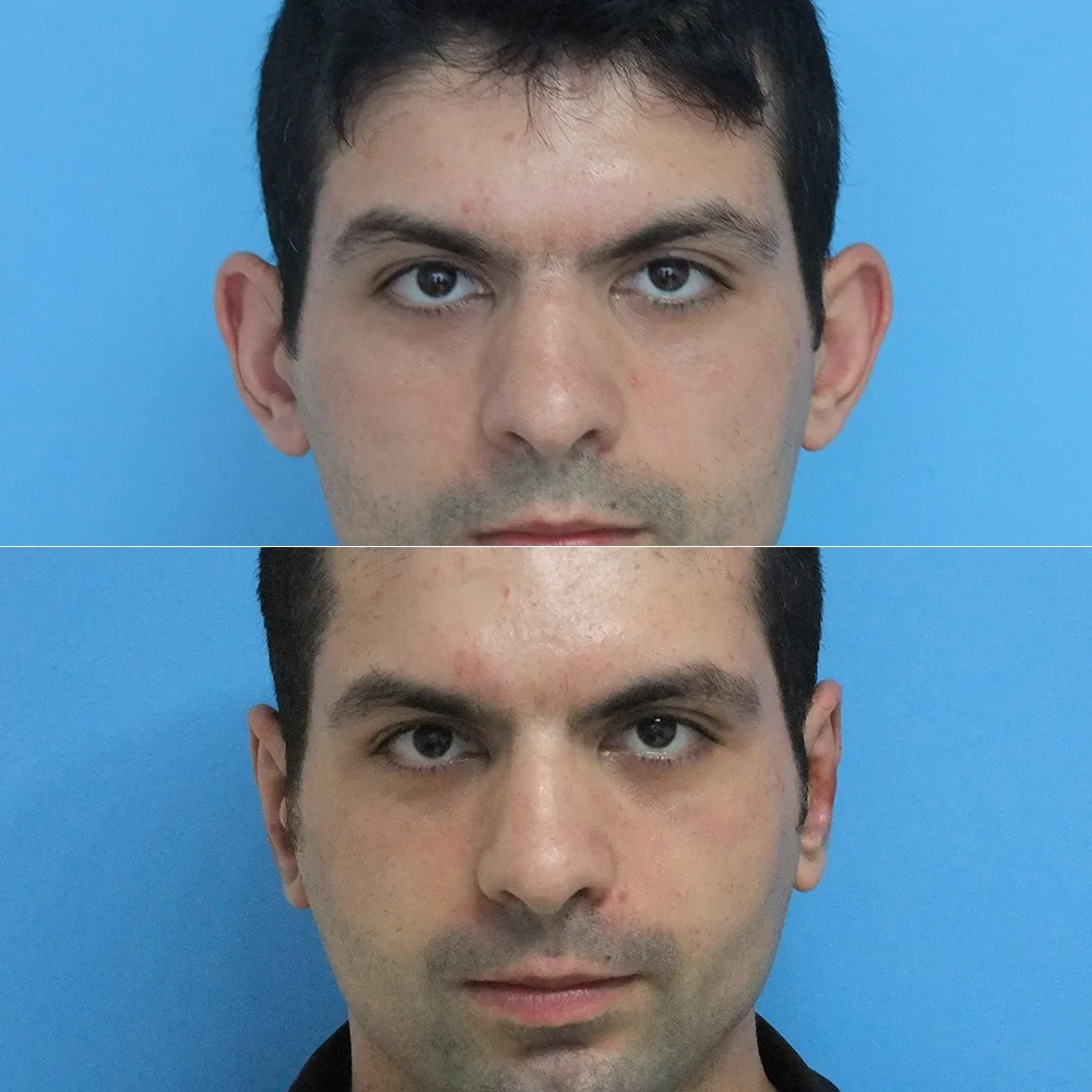 Case 02 — before and after