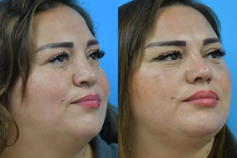 Case 01 — before and after