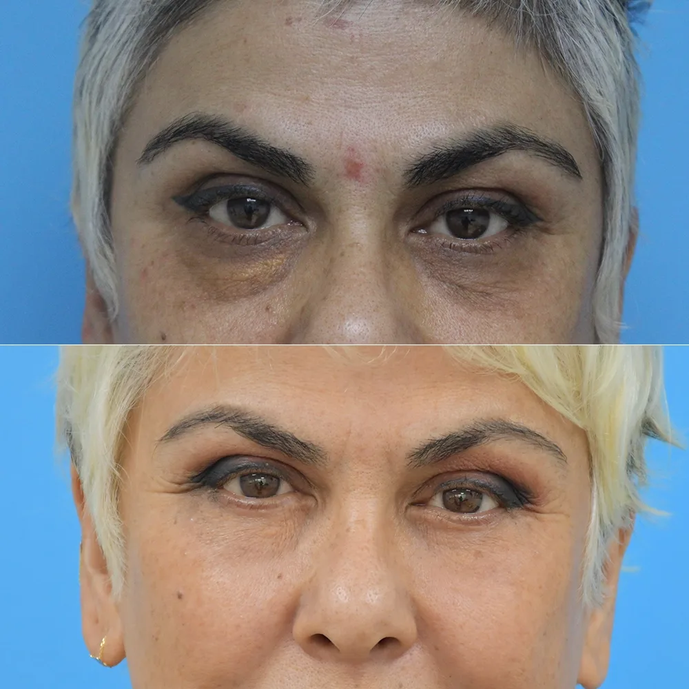 Case 08 — before and after
