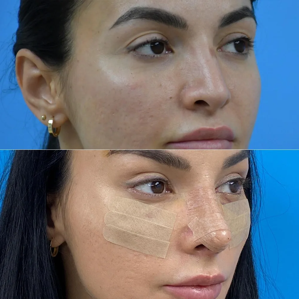 Case 07 — before and after