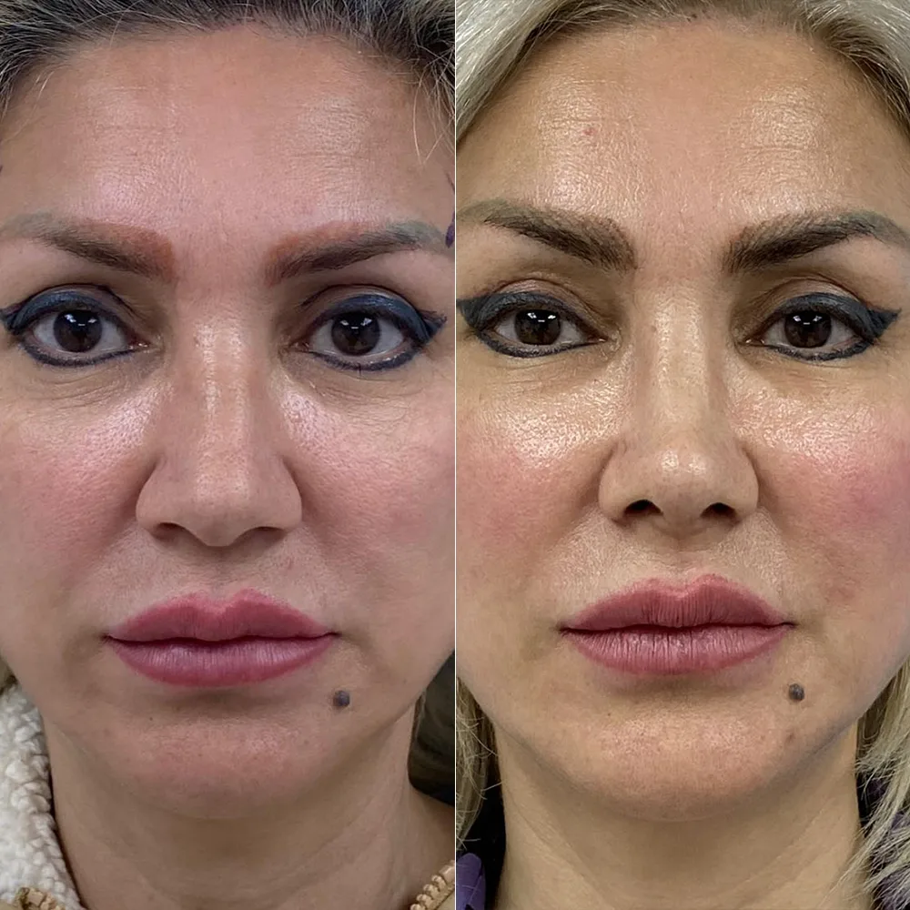 Case 02 — before and after