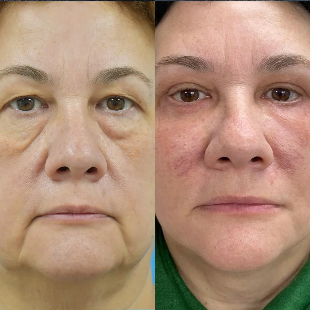 Case 02 — before and after
