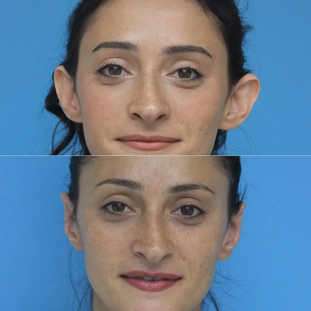Case 03 — before and after