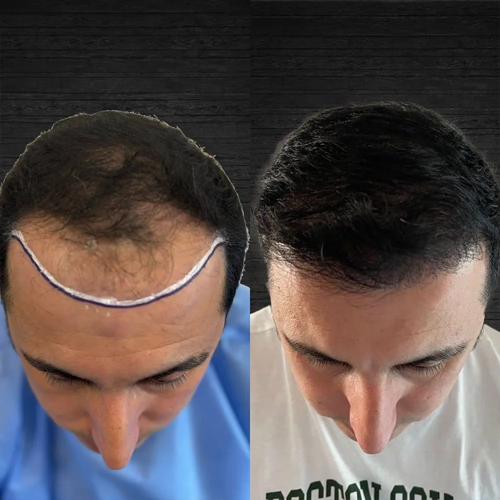 Case 04 — before and after