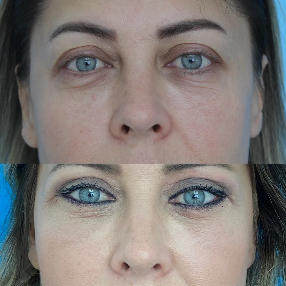 Case 01 — before and after