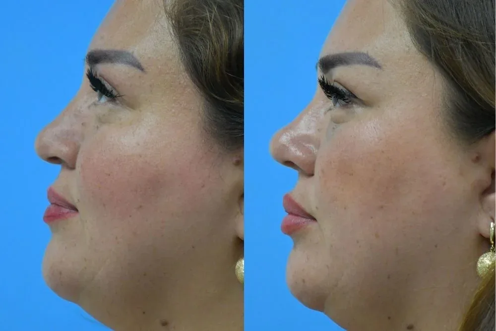Case 02 — before and after
