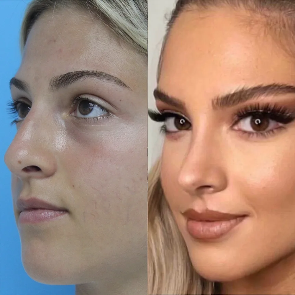 Case 03 — before and after