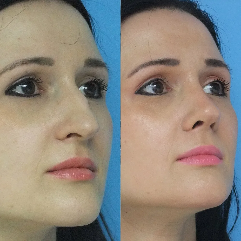 Case 06 — before and after