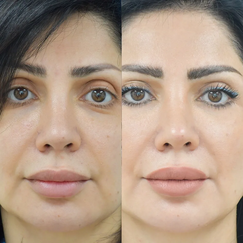 Case 06 — before and after