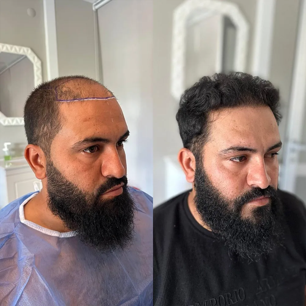 Case 06 — before and after